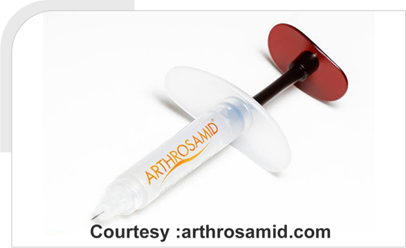 Joint Injection (Arthrosamid) img