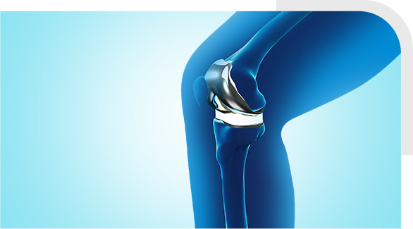 Mako SmartRobotics for Total Knee Replacement img