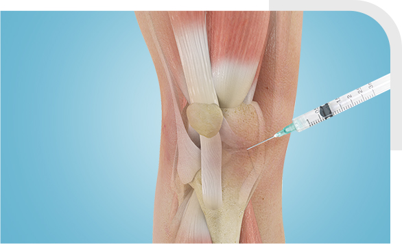 Nonoperative Orthopaedic Treatment img
