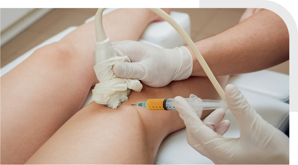 Platelet-Rich Plasma (PRP) Injection img