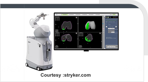 Robotic-Assisted Knee Replacement img