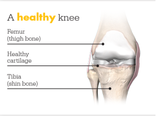 Healthy Knee Image