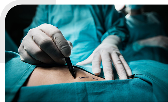Minimally Invasive img