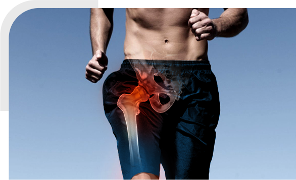 Revision Hip img