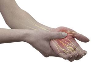 Hand Numbness pic