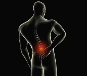 Lumbar Sprain