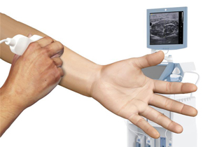 Musculoskeletal Ultrasound Scanning