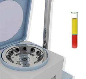 Platelet-Rich Plasma (PRP) Injection