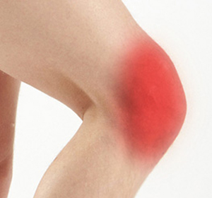 Knee Pain - Educational Picture
