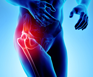 Hip Pain - Educational Picture