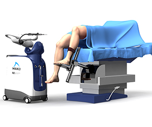 Robotic Assisted Knee Replacement - Educational Picture
