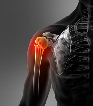 Fracture Care 