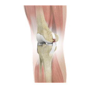 knee-ligament-injuries-img