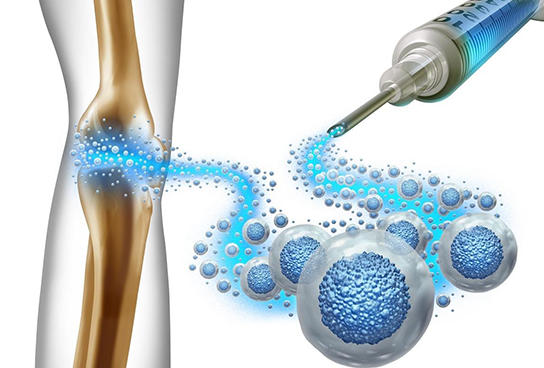 Regenerative Medicine/Orthobiologics-img