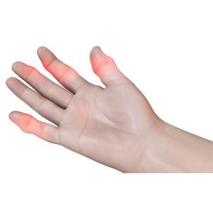 Picture of Finger Sprain