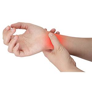 Picture of Wrist Sprain