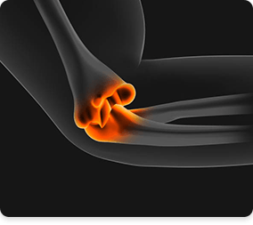 Picture of Elbow