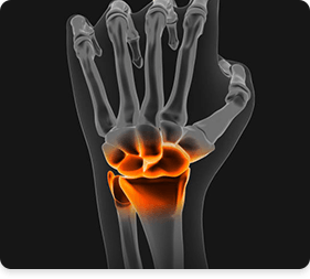Picture of Hand & Wrist
