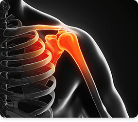 Picture of Shoulder