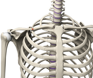 Clavicle Fracture - Educational Picture