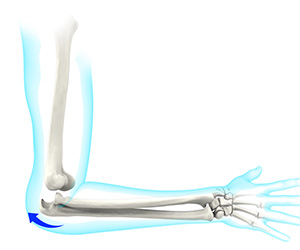 Elbow Instability - Educational Picture