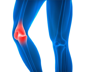 Knee Injury - Educational Picture