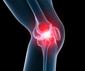 Knee Pain - Educational Picture