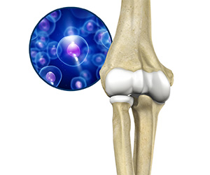Orthobiologic Treatments for the Elbow - Educational Picture