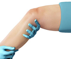 Physical Therapy for Knee - Educational Picture