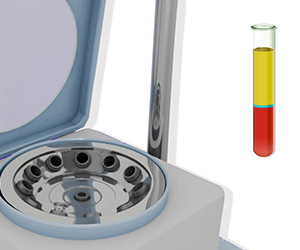 Platelet-Rich Plasma (PRP) Injection - Educational Picture