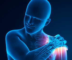 Post-traumatic Stiffness of the Shoulder - Educational Picture