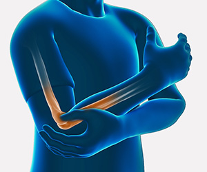 Post-traumatic Elbow Stiffness - Educational Picture
