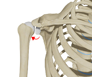 Posterior Shoulder Instability - Educational Picture