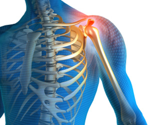 Shoulder Pain - Educational Picture