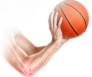 Throwing Injuries of the Elbow - Educational Picture