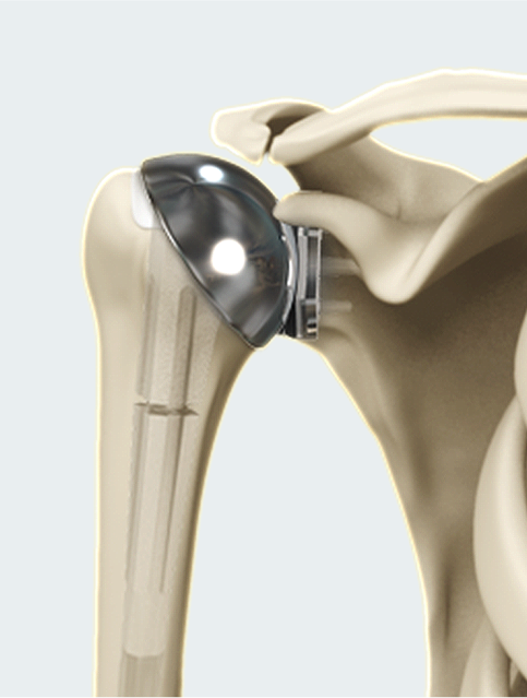 Shoulder image1