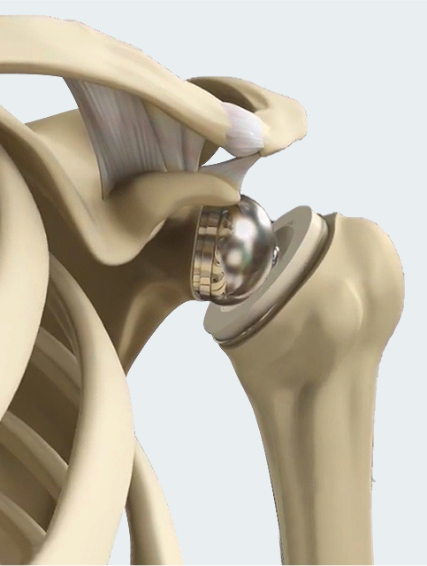 Shoulder image2