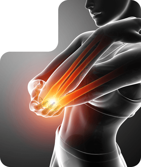 Picture of Elbow