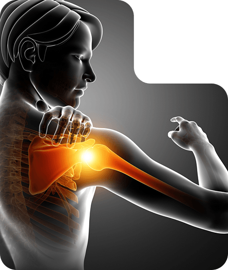 Picture of Shoulder