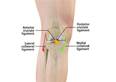 Picture of Knee Ligament Injuries