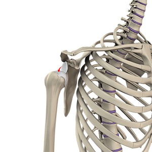 Picture of Shoulder Dislocation