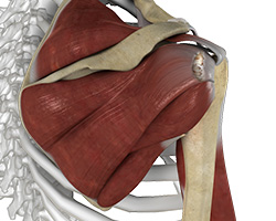 Picture of Shoulder Ligament Injuries