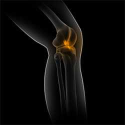 Picture of Sports Medicine