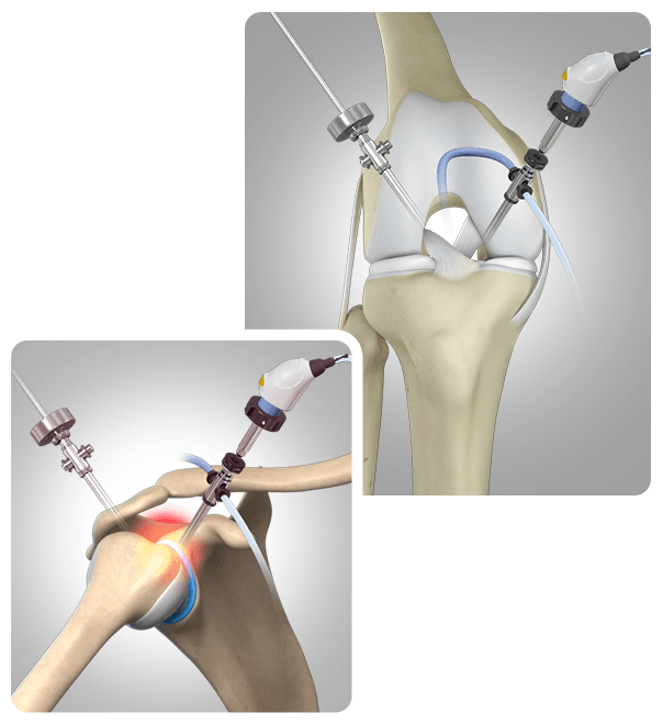 Picture of Surgery