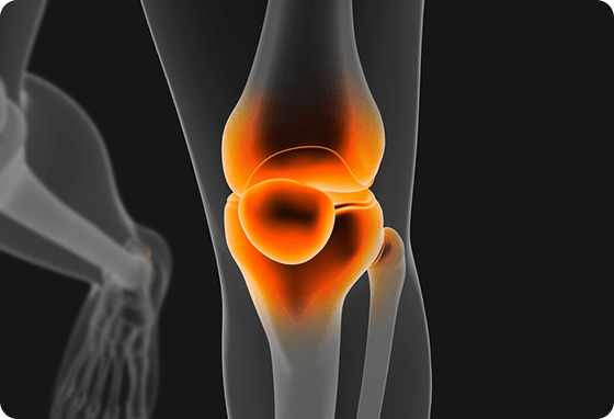Picture of Knee Care