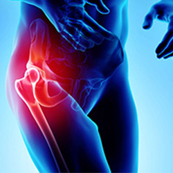 Picture of Hip Anatomy