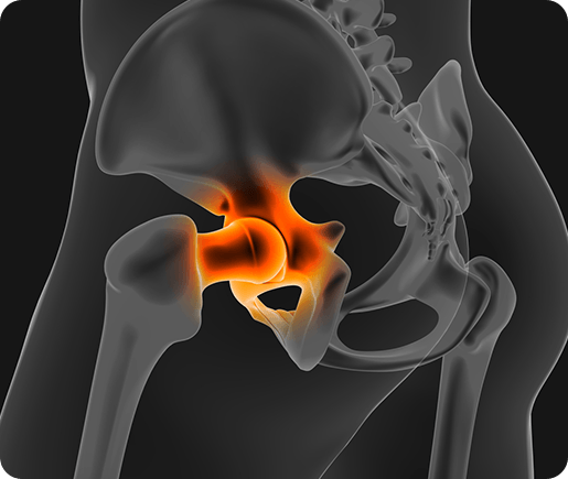 Visual representation of the hip joint in orange for education.