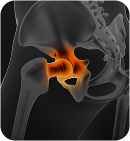 Visual representation of the hip joint highlighted in orange.