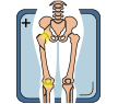 Diagram of a knee joint with a yellow arrow indicating the imaging area.