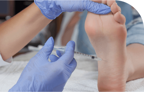 Picture of PRP (Platelet-Rich Plasma) Therapy